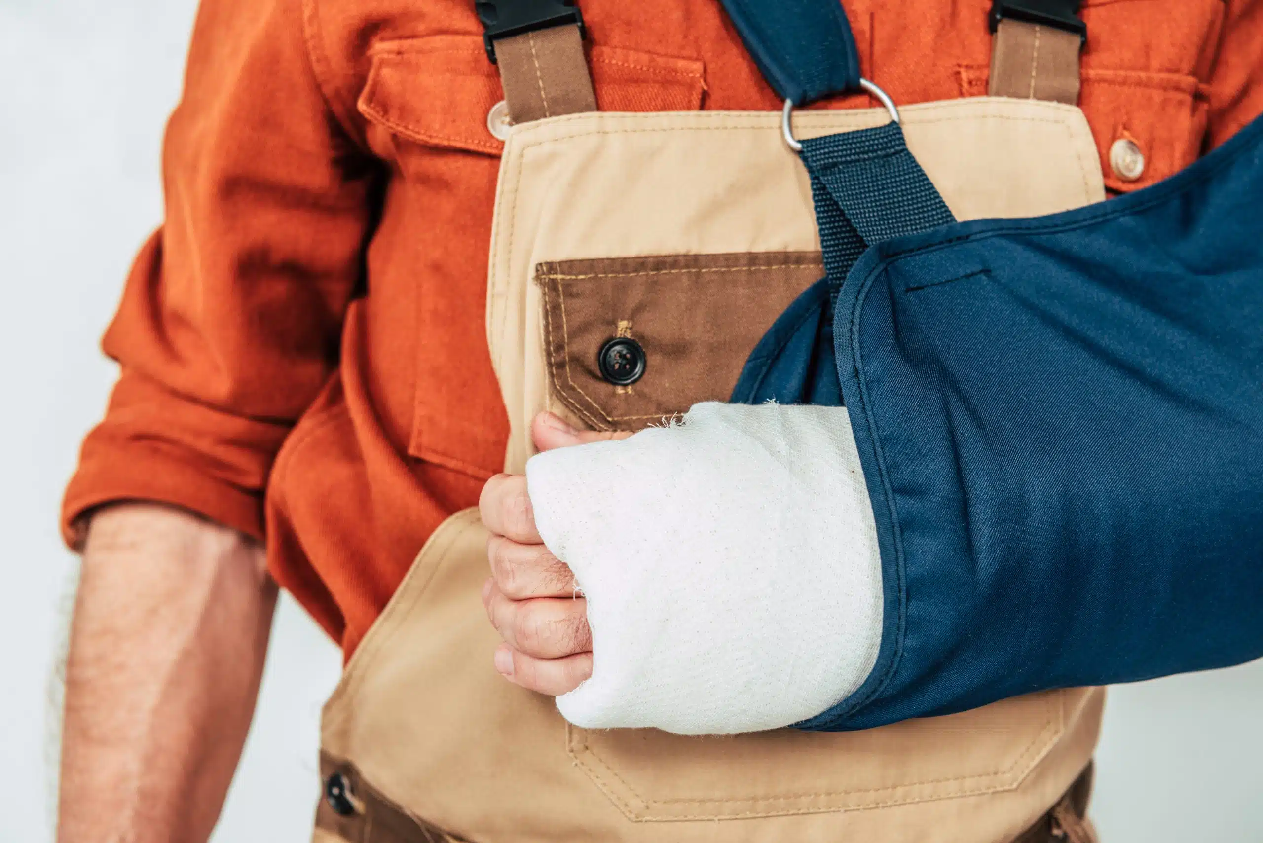 A Livingston Parish man with his arm in a cast after experiencing a personal injury.