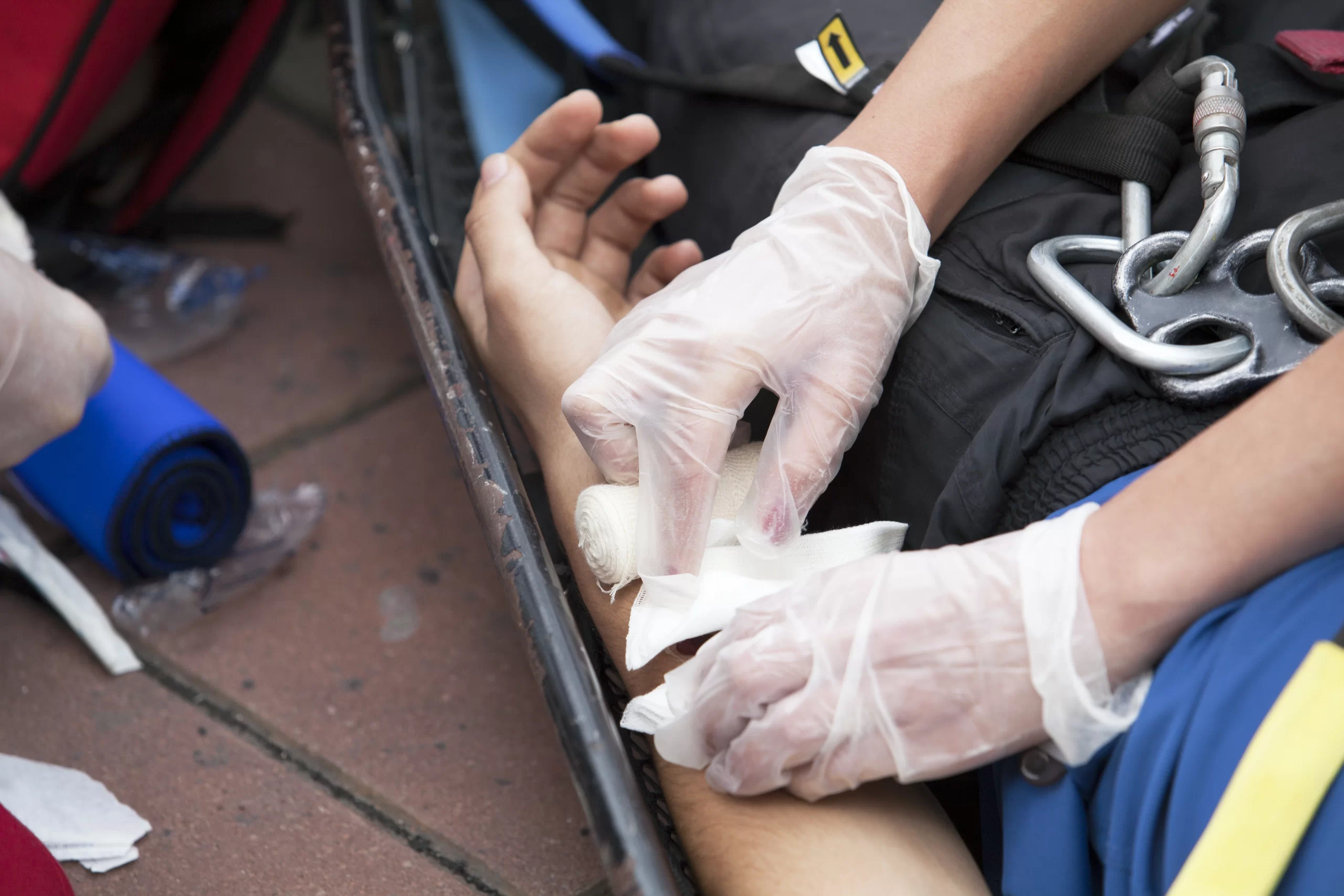 Baton Rouge Burn Injury Lawyer
